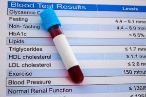 血管內的交通安全──LDL-C顆粒大小、數量與血管健康