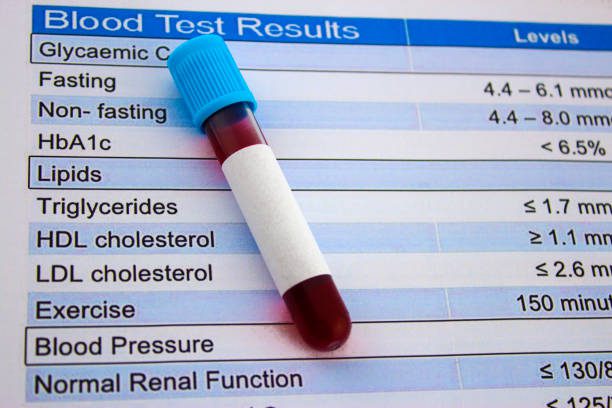 血管內的交通安全──LDL-C顆粒大小、數量與血管健康